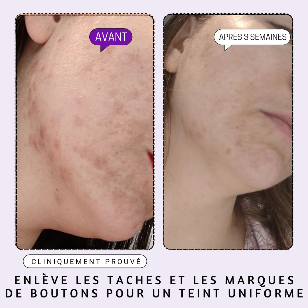 DERMACLEAR - Sérum Visage aux 10 Actifs