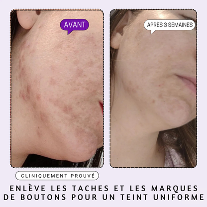 DERMACLEAR - Sérum Visage aux 10 Actifs