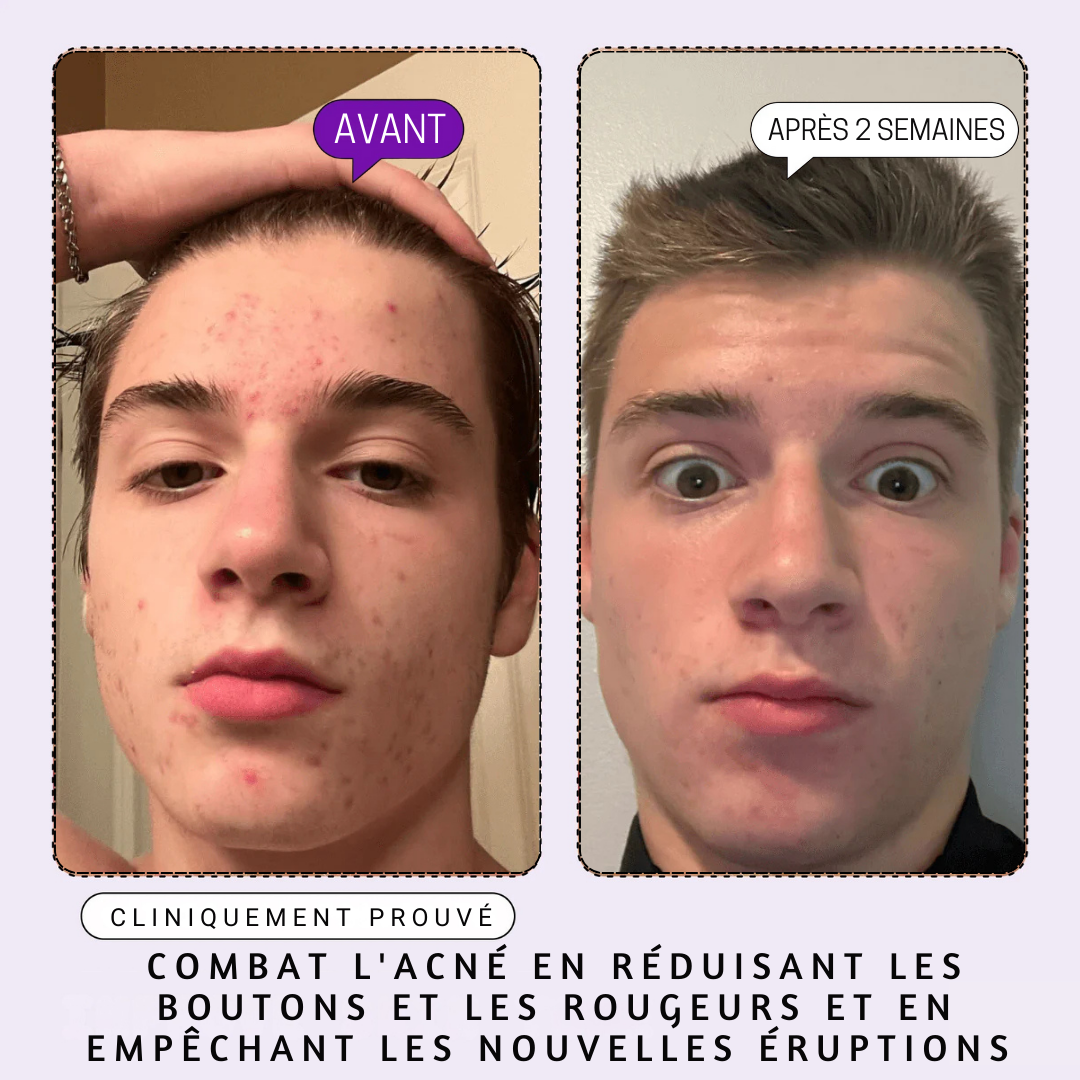 DERMACLEAR - Sérum Visage aux 10 Actifs