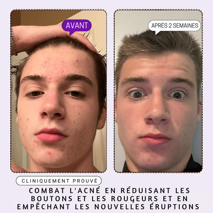 DERMACLEAR - Sérum Visage aux 10 Actifs