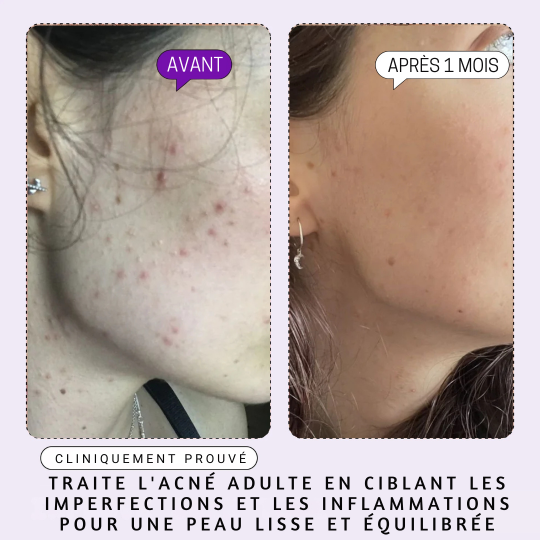 DERMACLEAR - Sérum Visage aux 10 Actifs